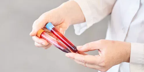 Teste de sangue da Grail promete detectar câncer precocemente por US$ 700