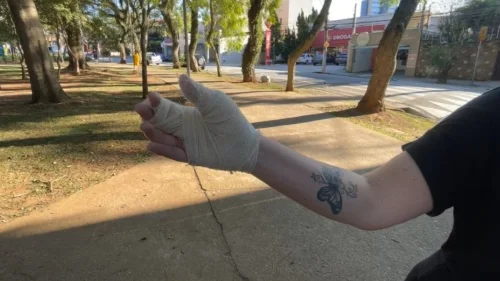 Mulher é atacada por pitbull ao proteger cachorra em praça de Santo André