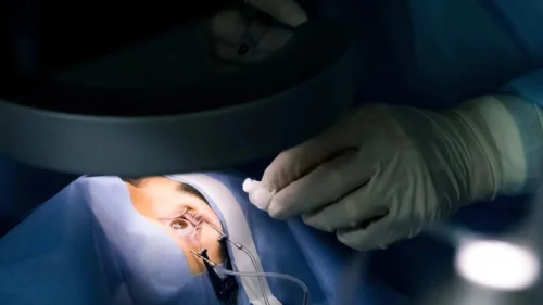Queratopigmentação: cirurgia que muda cor dos olhos gera polêmica entre especialistas