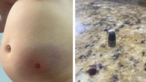 Bebê de 11 meses é atingida por bala perdida durante festa de Réveillon em SP