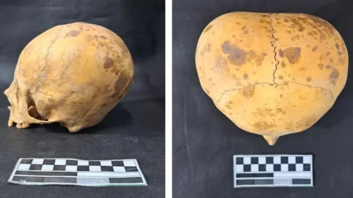 Crânio de criança de 700 anos com deformação intencional é encontrado na Argentina