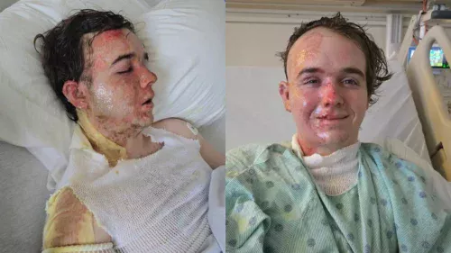 O verdadeiro motivo por trás do ataque com óleo quente no McDonald's que deixou jovem na UTI